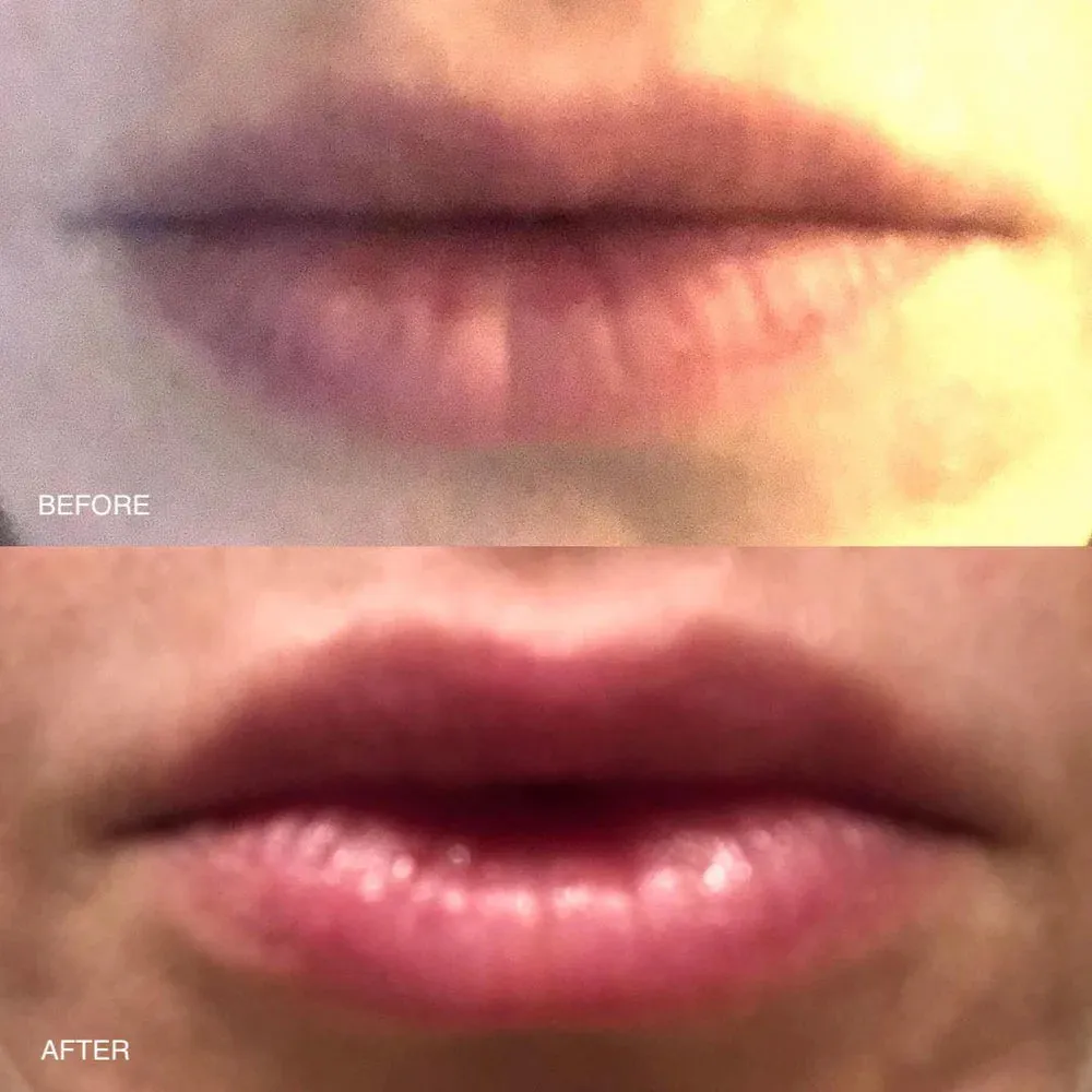 MACRENE actives High Performance Lip Filler